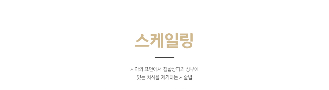 스케일링